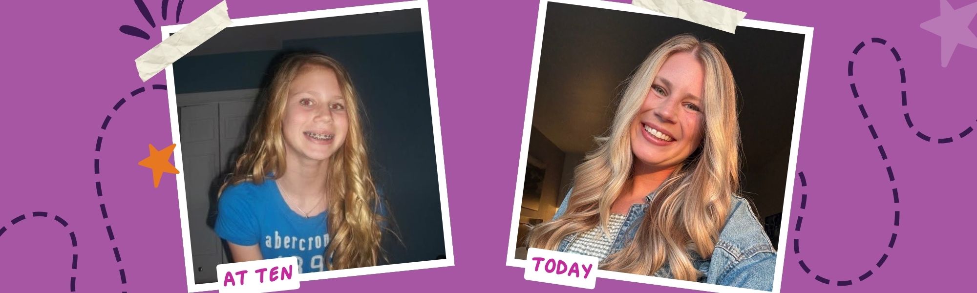 Graphic with photo of girl at ten and girl now.